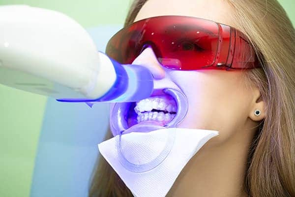 Laser teeth whitening treatments Bedfordshire