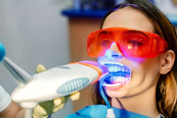 Simplifying Teeth Whitening: A Comprehensive Guide Bedfordshire