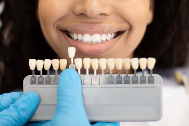 Laser Teeth Whitening: Exploring the Longevity of Your Brighter Smile Bedfordshire