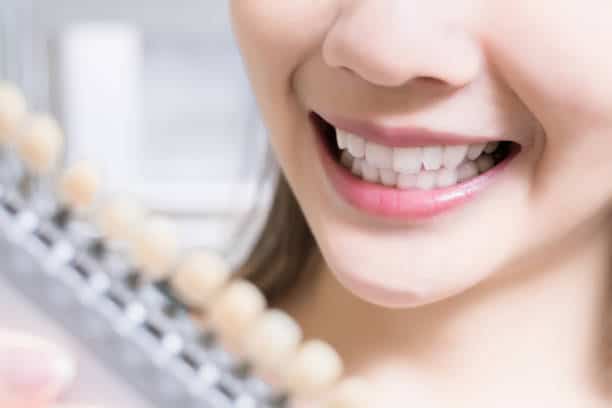 Teeth Whitening Kings Norton Bedfordshire