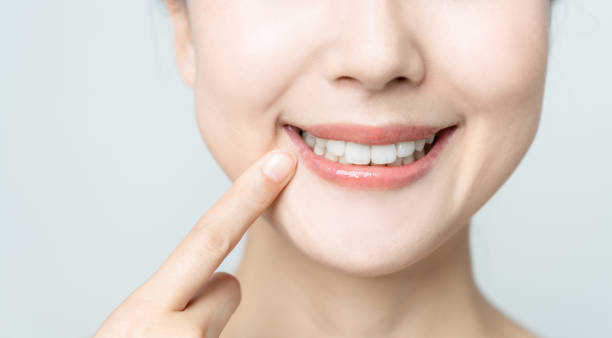 Comparing the Pain Factor: Laser Teeth Whitening vs. Zoom Teeth Whitening Bedfordshire