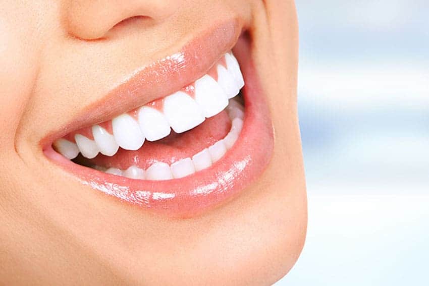 Teeth Whitening Abingdon Bedfordshire