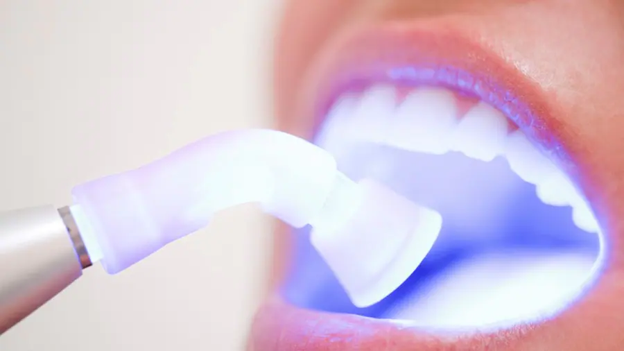 Teeth Whitening Aylesbury Bedfordshire