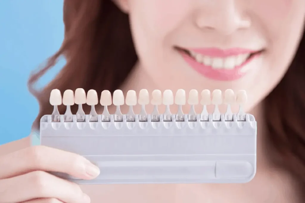 What Happens During a Laser Teeth Whitening Session in Bedfordshire
